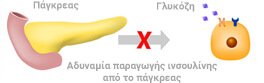 Diavitis typou 1