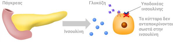 Diavitis typou 2
