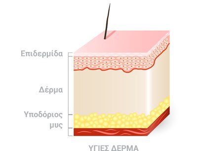 Δέρμα χωρίς ψωρίαση