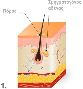 στάδια Πόρος Σμηγματογόνος αδένας