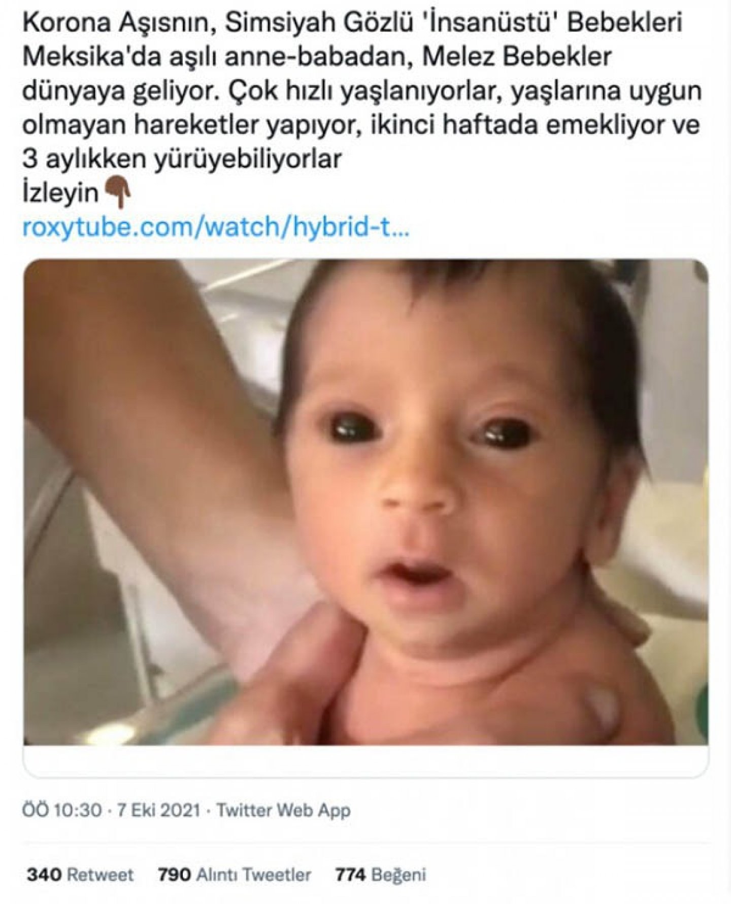 Fotografin Covid 19 Asisi Sebebiyle Simsiyah Gozlerle Dogan Insanustu Bebegi Gosterdigi Iddiasi Dogruluk Payi