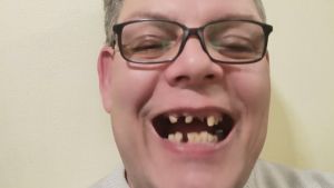 Да помогнем Ники отново да се усмихва | Сайт за дарения | Дарителски кампании | Без комисионна