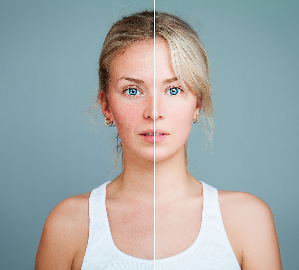 skin irritations