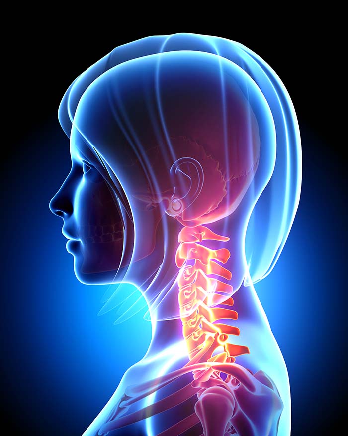 neck pain relief