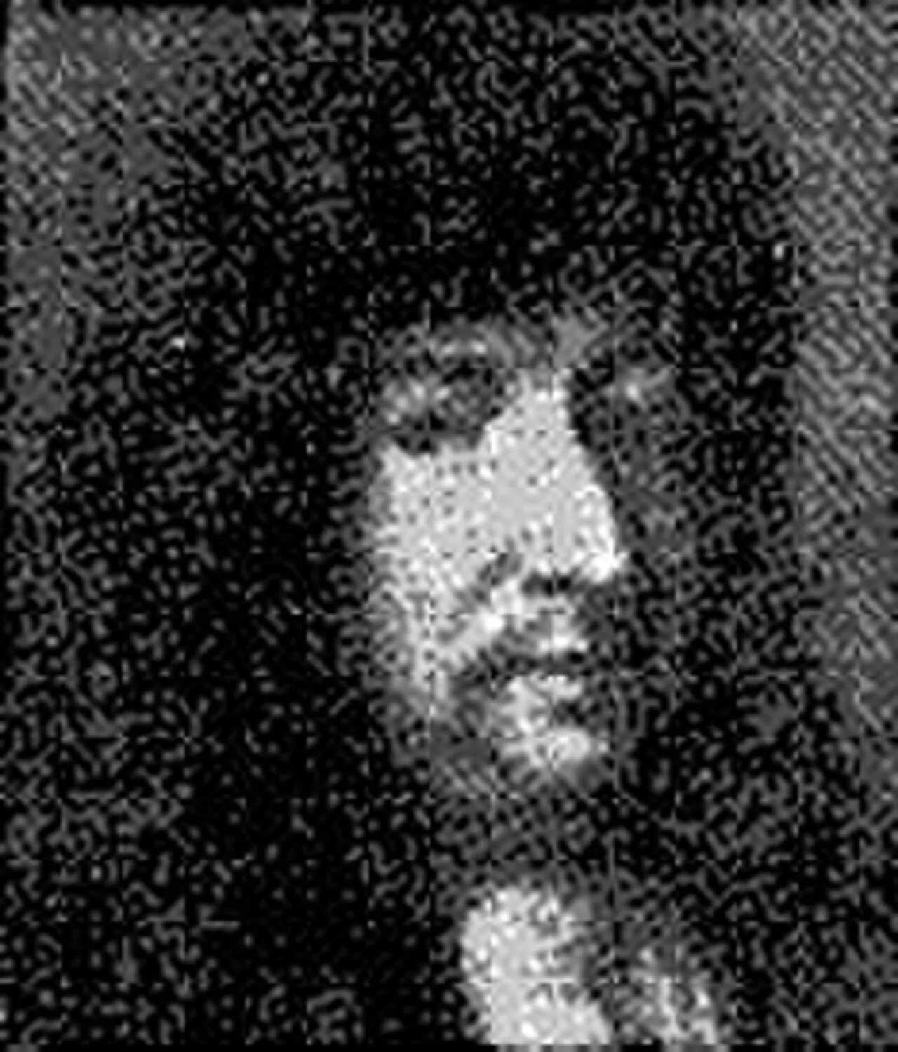 Gustaf Lilliecrona