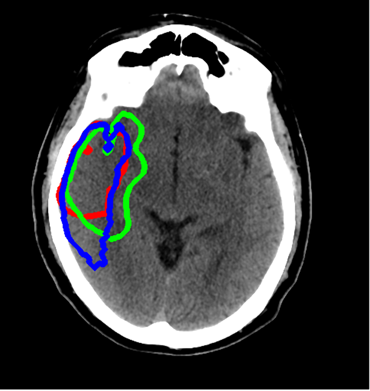 fig1_small.png fig1_small.png
