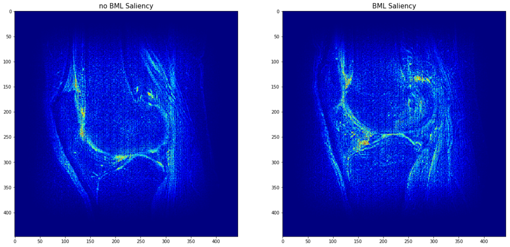 bml_saliency.png bml_saliency.png