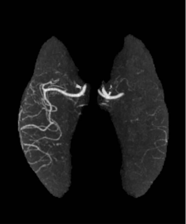 mca mip.png mca mip.png