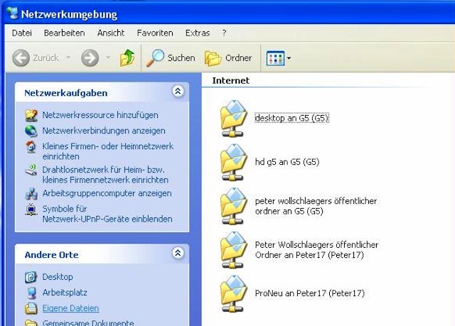 net xp net xp