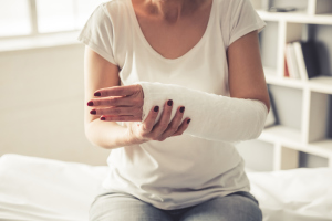 Frau mit eingegipstem Arm Frau mit eingegipstem Arm