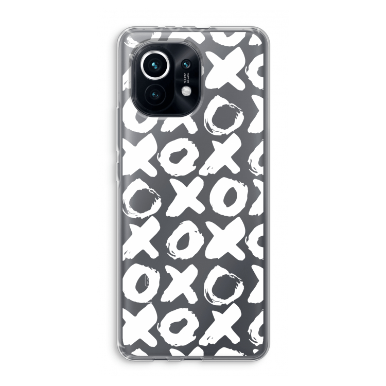 XOXO: Xiaomi Mi 11 Transparant Hoesje
