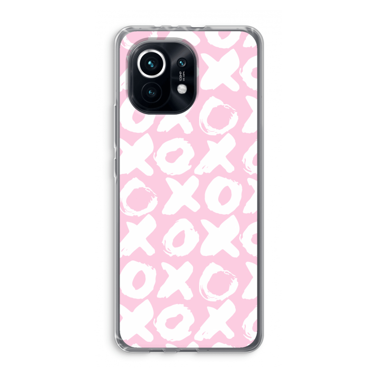XOXO: Xiaomi Mi 11 Transparant Hoesje