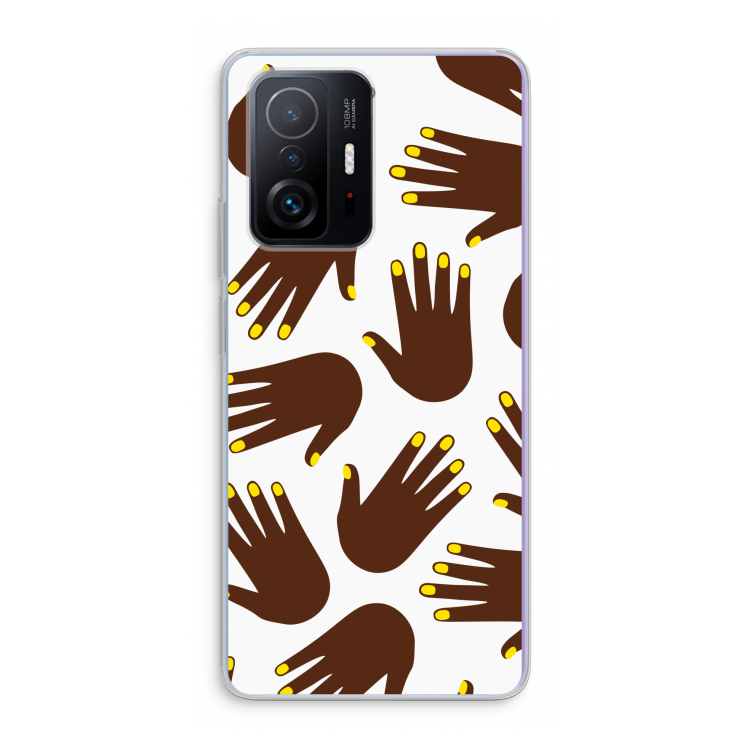 Hands dark: Xiaomi 11T Transparant Hoesje
