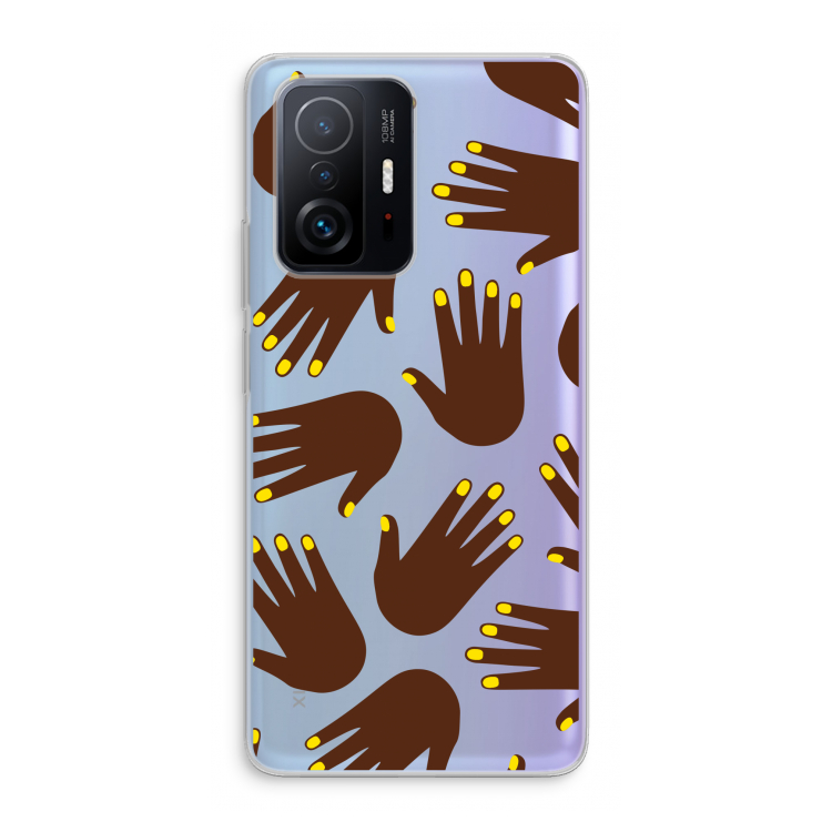 Hands dark: Xiaomi 11T Transparant Hoesje