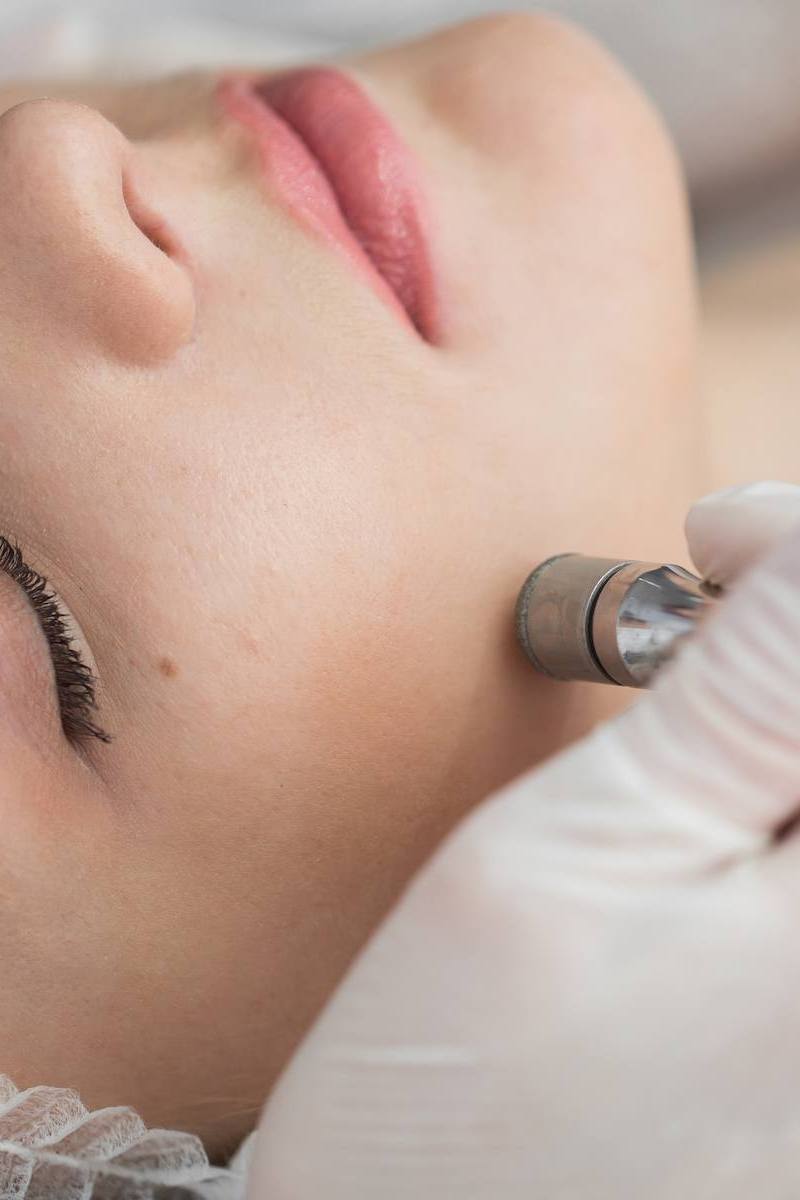 Diamond microdermabrasion
Classic