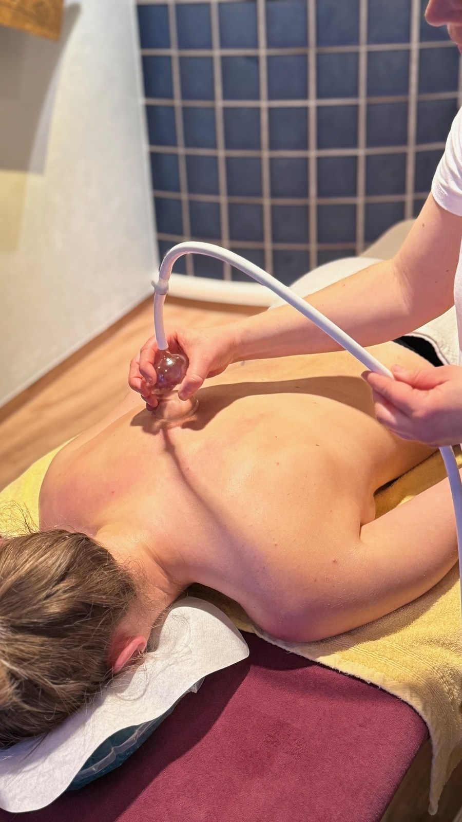 Cupping massage
