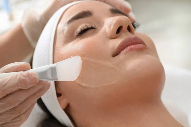 Medical Skin Peeling - Dr. Rottensteiner