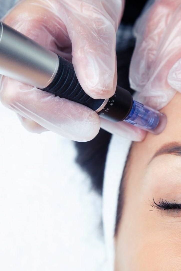 Glow treatment
