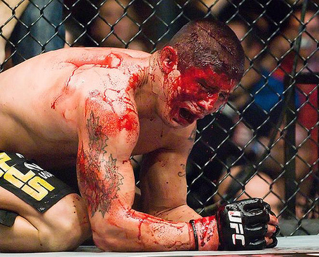 5 dita di Violenza: B.J. Penn vs. Joe "Daddy" Stevenson 6