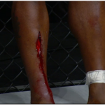One FC 3 - risultati & Video 4