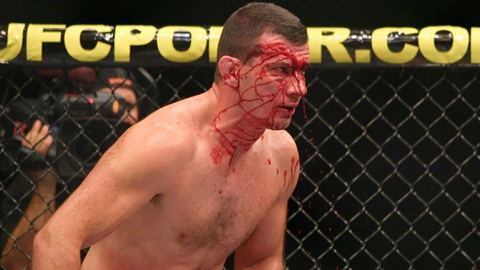 UFC on FX 6: fuori Perosh 2