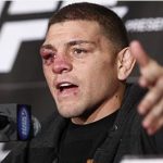 Nick Diaz non combatterà più a meno che... 1