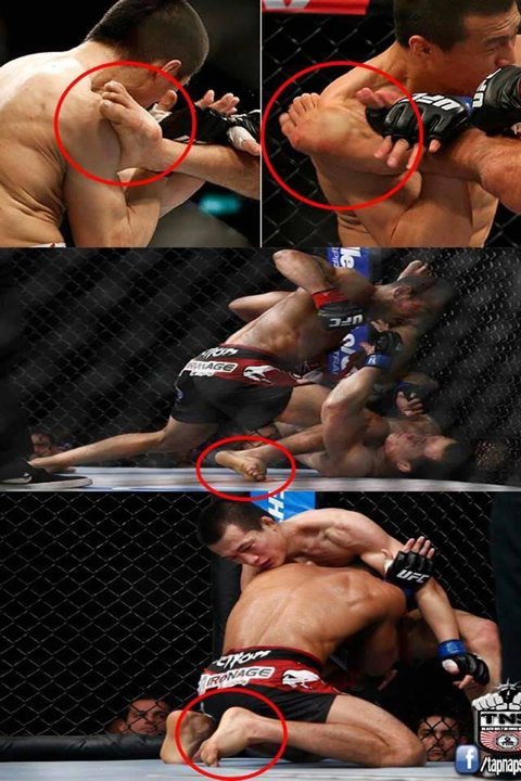 jose-aldo-piede