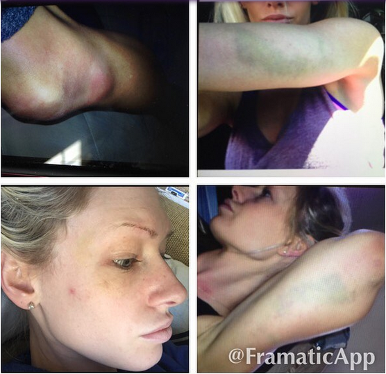 Travis-brown-violenza