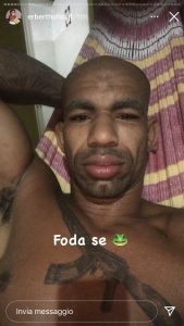 Erberth Santos fa il rito del Kambo, con il veleno di una rana amazzonica (foto) 3