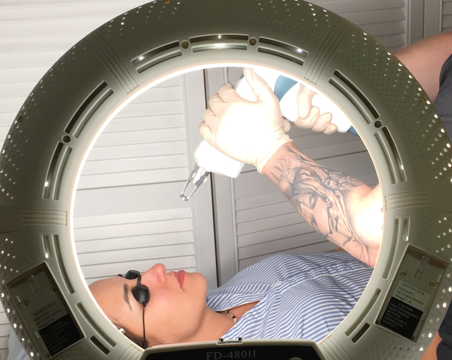 Удаление лазером митино. Александритовый лазер. Удаление лазером митино. Удаление лазером митино. Лазерная эпиляция кандела.