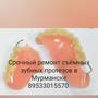 фото Ремонт съемных зубных протезов 3