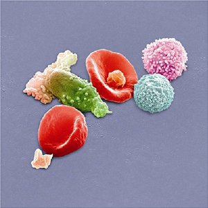 PETER GABRIEL - NEW BLOOD (DVD+CD) (DVD) PETER GABRIEL - NEW BLOOD (DVD+CD) (DVD)