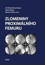 Zlomeniny proximálního femuru - Kolektiv