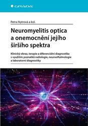 Neuromyelitis optica a poruchy jejího šišího spektra