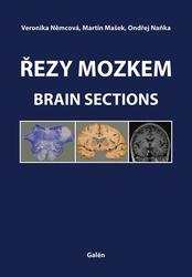 Řezy mozkem