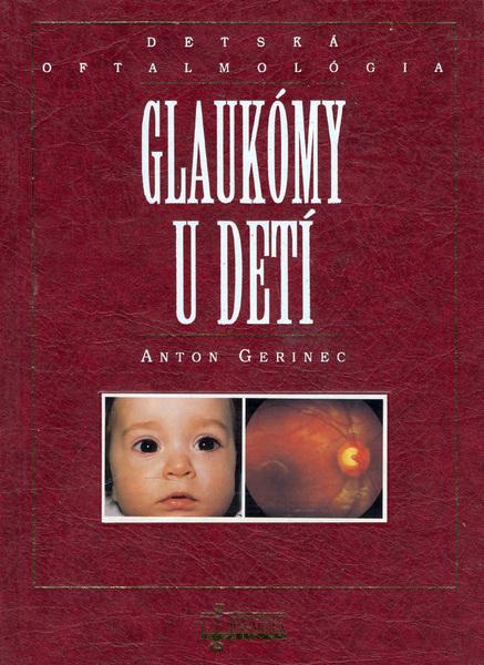 Glaukómy u detí - 80-8063-103-4