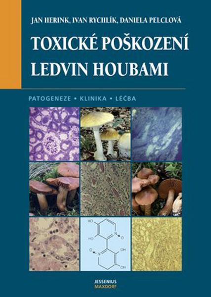 Toxické poškození ledvin houbami - 80-7345-122-0