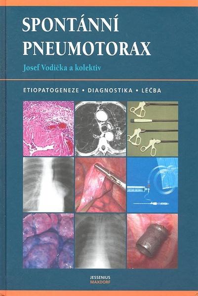Spontánní pneumotorax - 80-7345-126-3