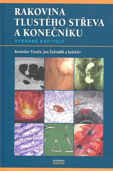 Rakovina tlustého střeva a konečníku - vybrané kapitoly Vyzula Rostislav, Žaloudík Jan a kolektiv - 80-7345-140-9