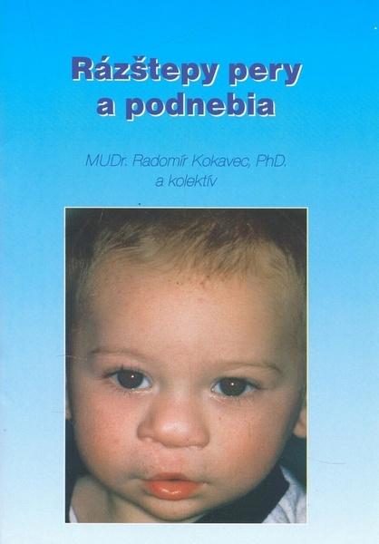 Levně Rázštepy pery a podnebia