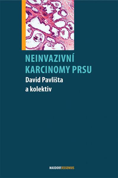 Neinvazivní karcinomy prsu - 978-80-7345-173-8