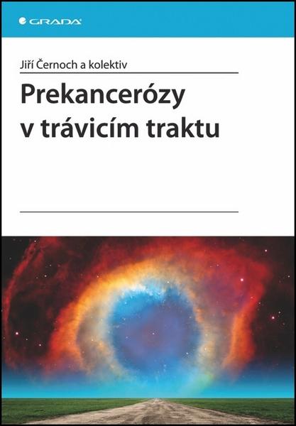 Prekancerózy v trávicím traktu - 978-80-247-3500-9