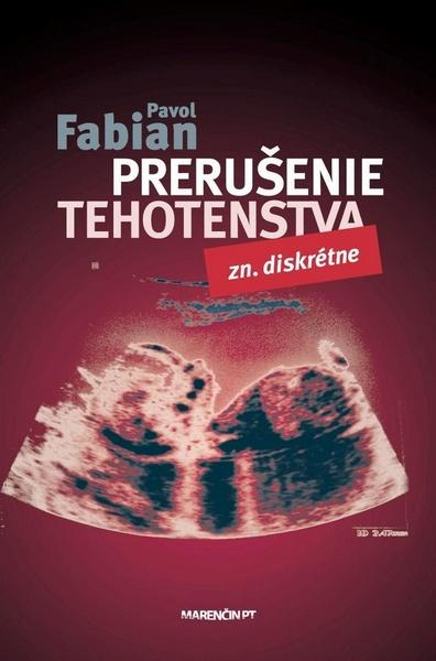 Prerušenie tehotenstva - 978-80-8114-120-1