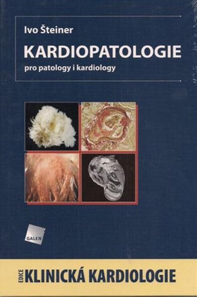 Kardiopatologie - 978-80-7262-672-4