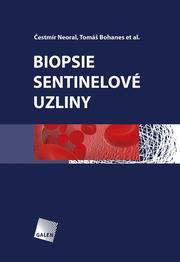 Biopsie sentinelové uzliny - 978-80-7262-882-7