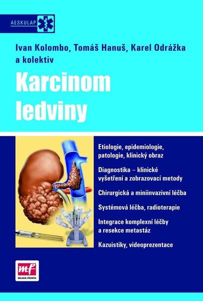 Karcinom ledviny + DVD - doc. MUDr. Karel Odrážka, Ph.D. - 978-80-204-2344-3