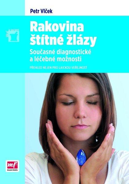 Rakovina štítné žlázy - 978-80-204-2799-1