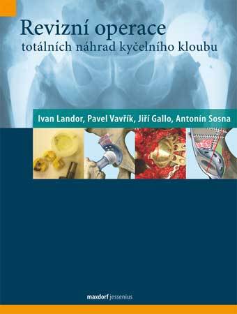 Levně Revizní operace totálních náhrad kyčelního kloubu