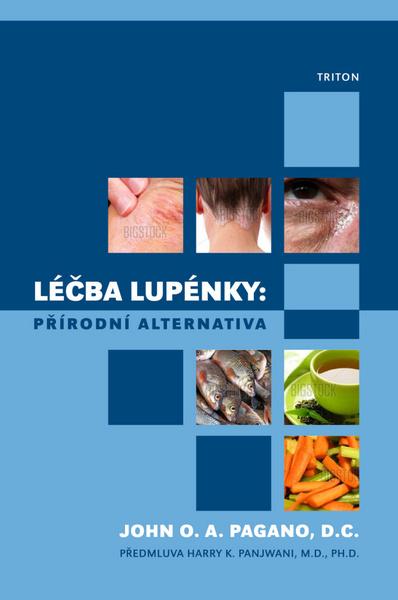 Léčba lupénky: Přírodní alternativa - 978-80-7387-556-5