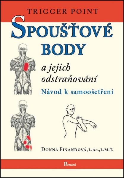 Spoušťové body a jejich odstraňování - 978-80-87419-28-1